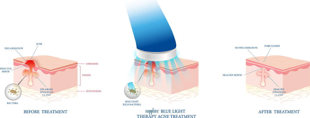 How Sapphire Works?